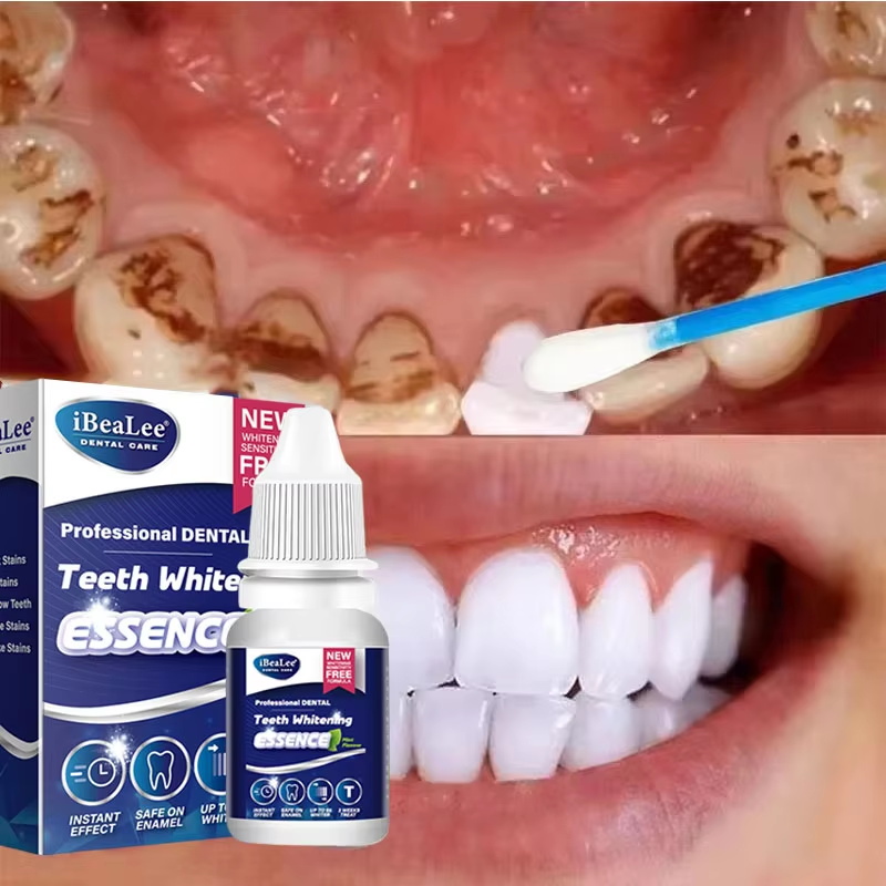 Teeth Whitening Serum - Zahnaufhellungsessenz, entfernt Plaqueflecken, Serum, frischer Atem,