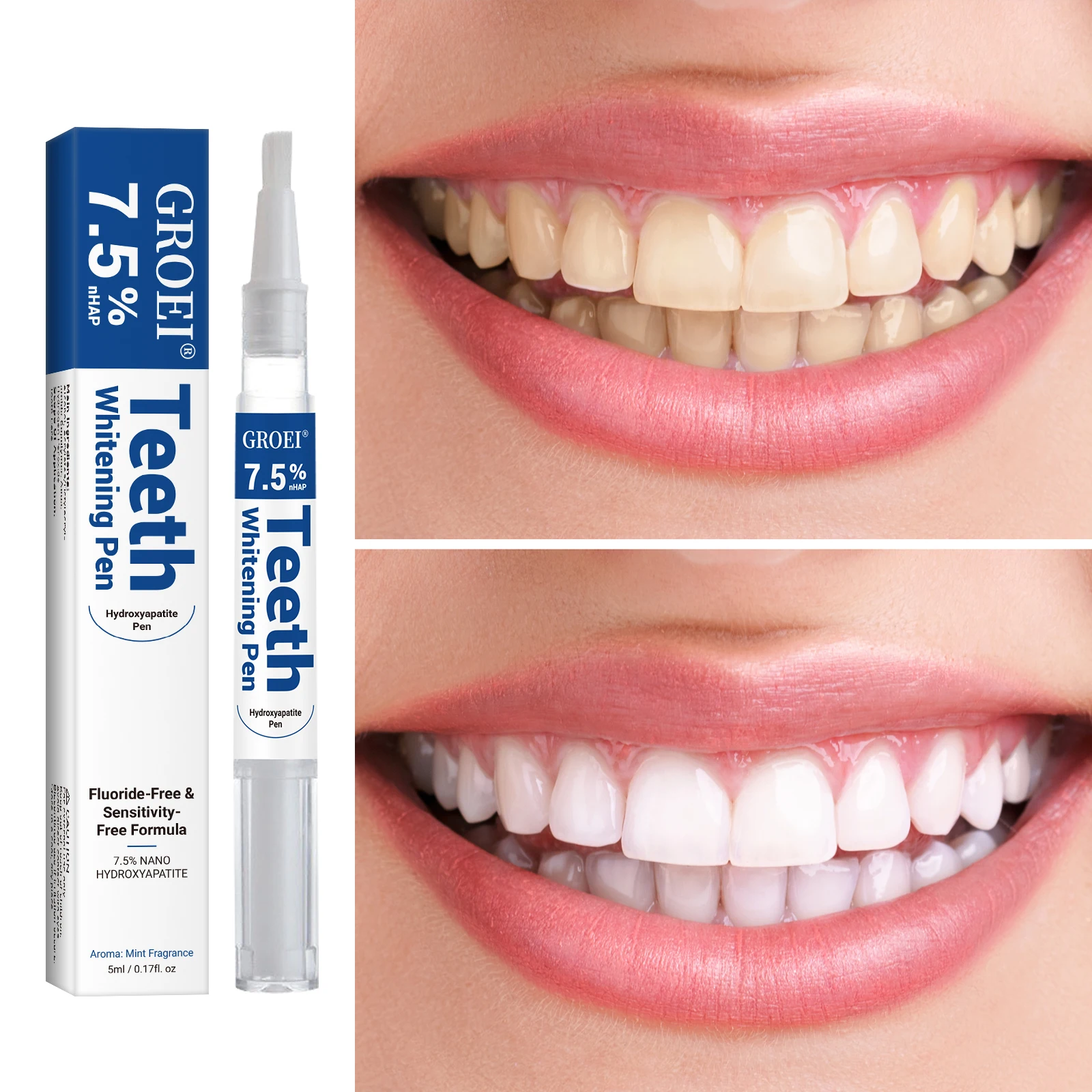 Hydroxyapatite Zahnaufhellungs – Teeth Whitening With Peroxide Bewertung und Preis