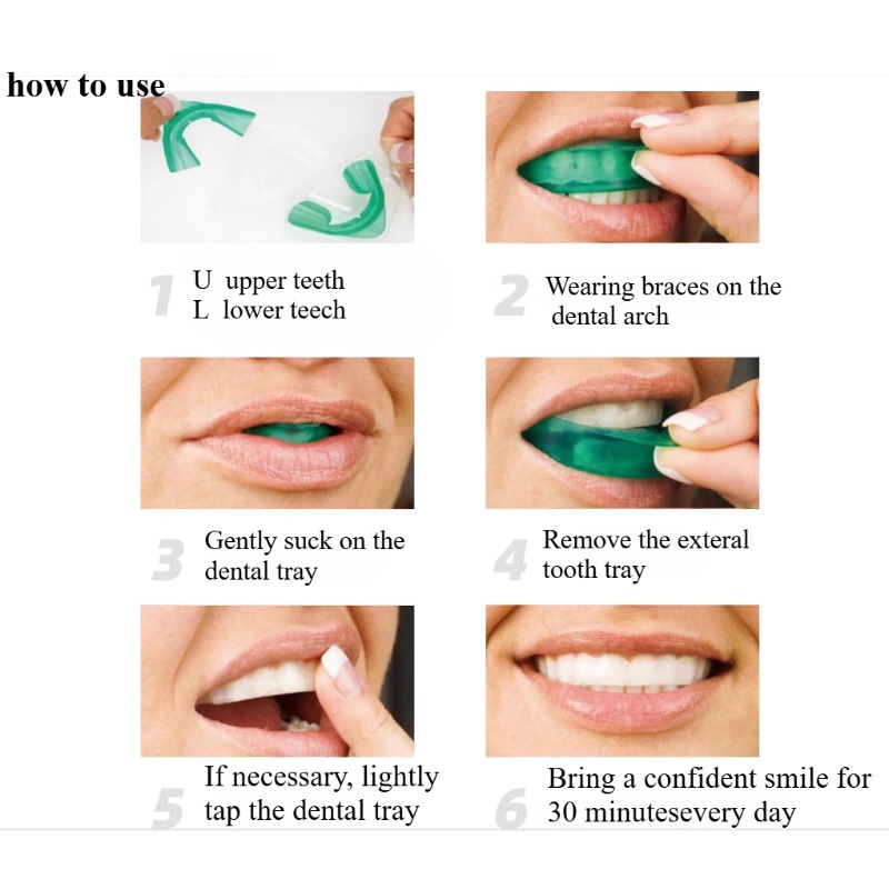 Set Zahnaufhellungstablett, U- – Teeth Whitening For Trays Bewertung und Preis
