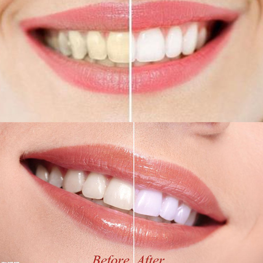 Bambus Holzkohle Zähne Zahn De – Teeth Paint Whitening Bewertung und Preis