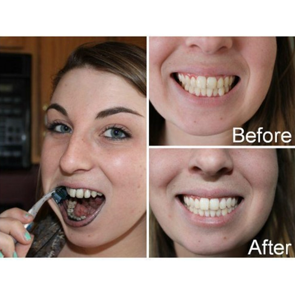 Bambus Holzkohle Zähne Zahn De – Teeth Paint Whitening Bewertung und Preis