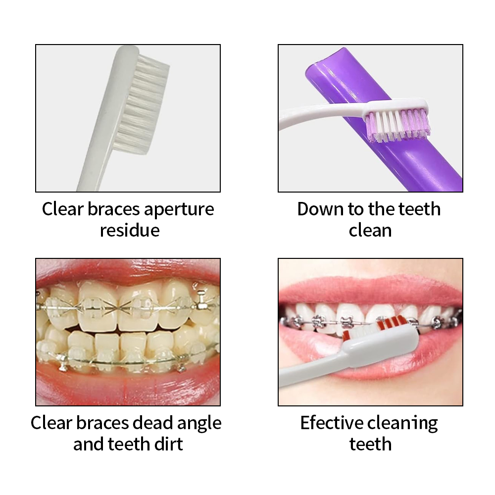 8 Teile/satz Kieferorthopädisc – Teeth Whitening Brush Bewertung und Preis