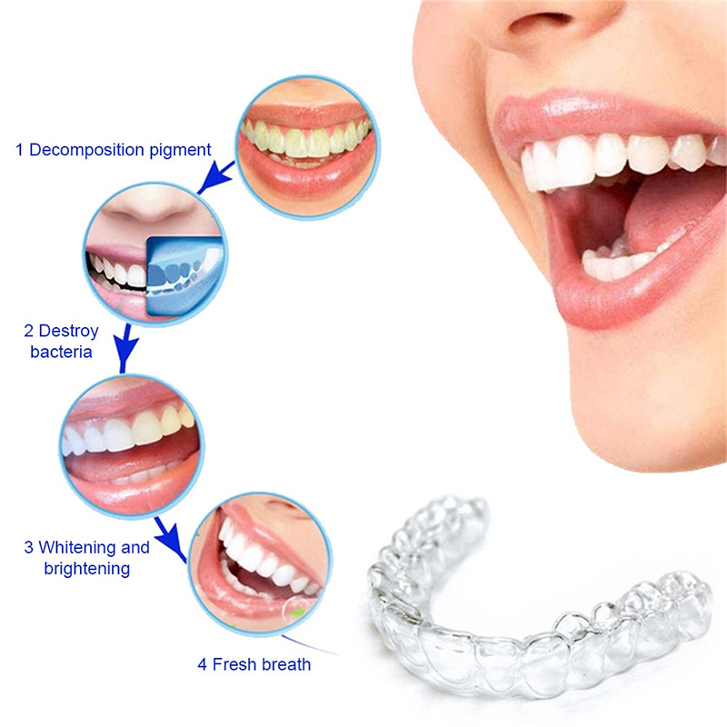 Komfortabler Silikon-Mundschut – Teeth Whitening For Trays Bewertung und Preis