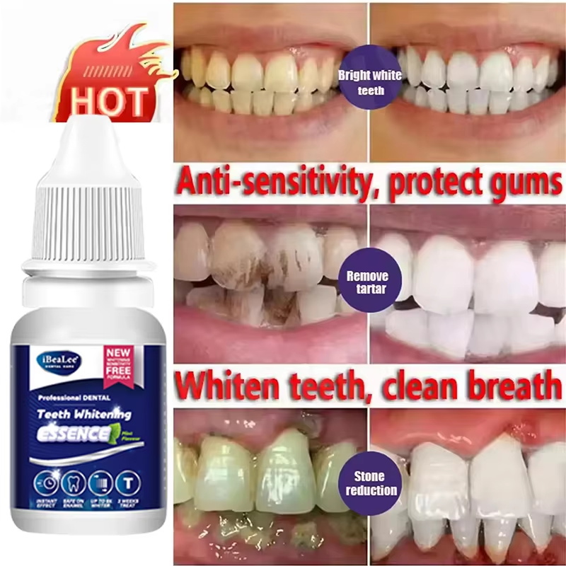 Zahnaufhellungsessenz, entfern – Teeth Whitening Serum Bewertung und Preis