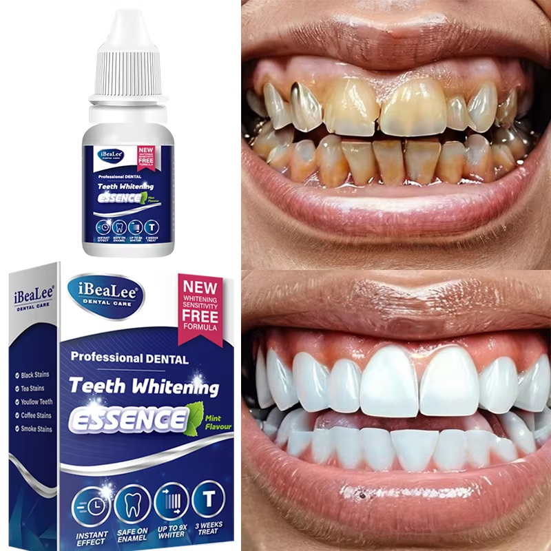Zahnaufhellungsessenz, entfern – Teeth Whitening Serum Bewertung und Preis