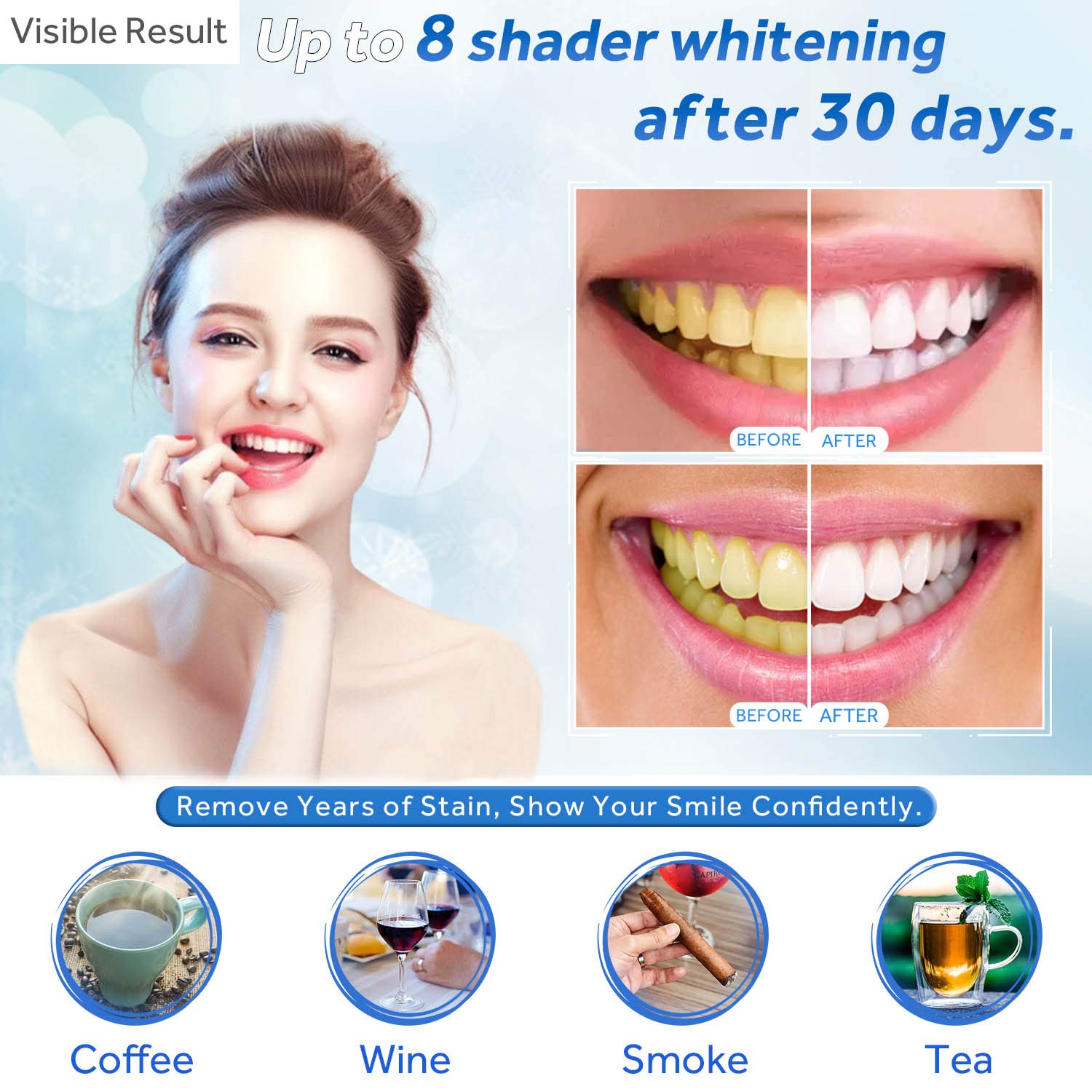 Zahnaufhellungsgel, Nachfüllsp – Teeth Whitening For Trays Bewertung und Preis