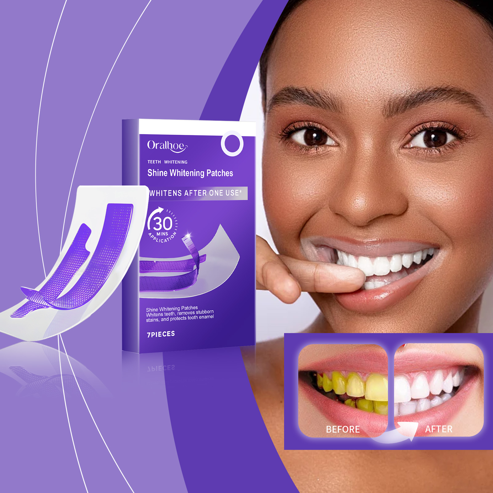 Lila Zahnaufhellungsstreifen – – Teeth Whitening Strips Crest Bewertung und Preis