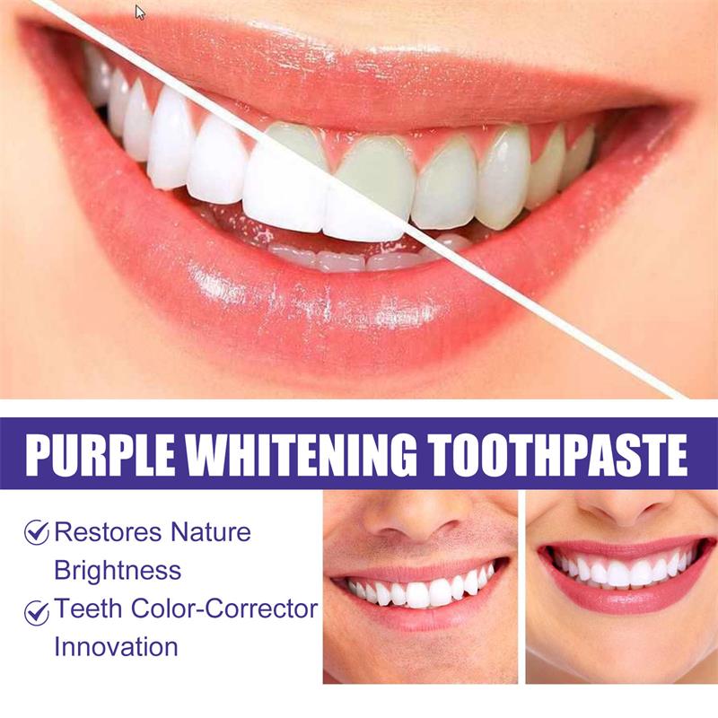 9D Lila Zahnaufhellungs-Zahnpa – Remineralizing Toothpaste Bewertung und Preis