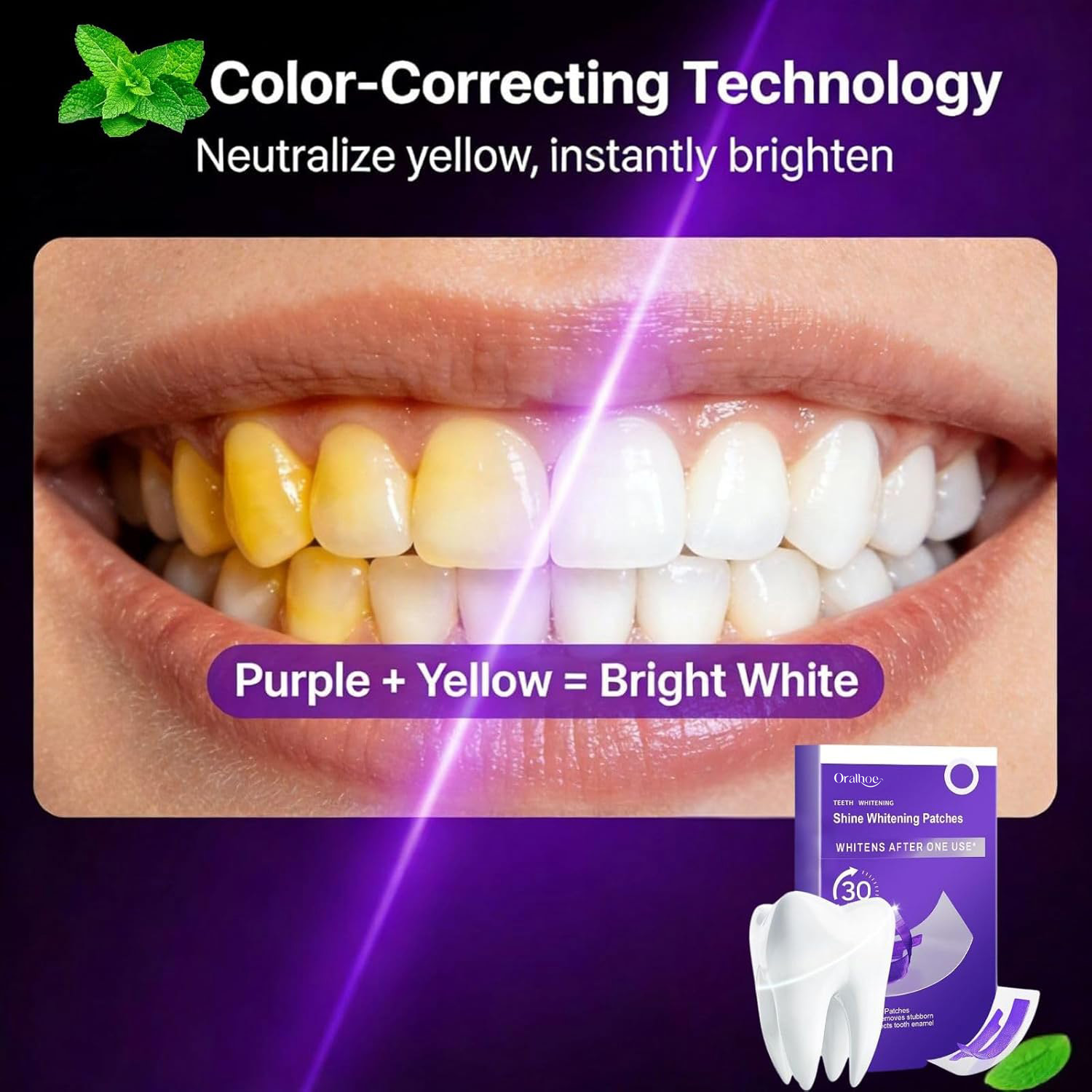 Lila Zahnaufhellungs-Kombi-Set – Teeth Whitening In Office Bewertung und Preis