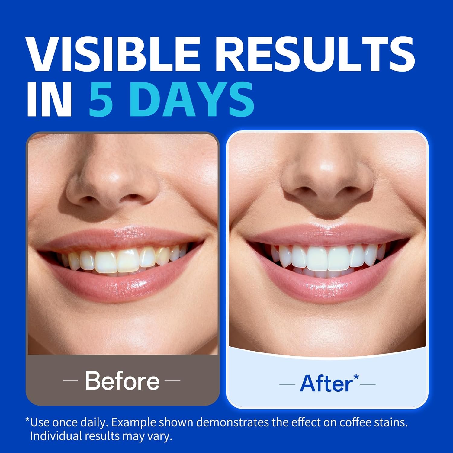 1/7 Paar Zahnaufhellungsstreif – Teeth Whitening Strips Crest Bewertung und Preis