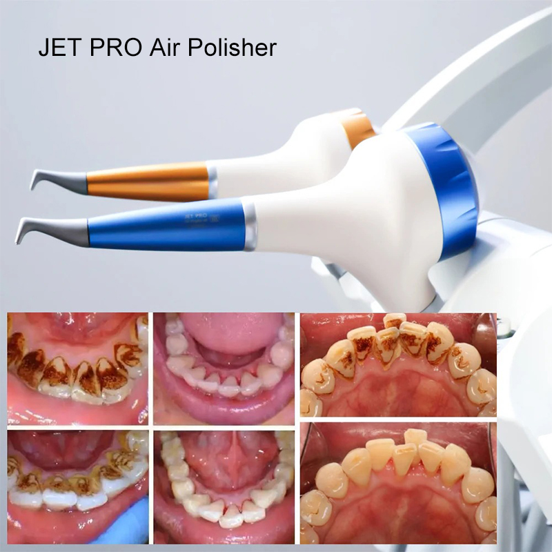 VV Dental Luftpoliergerät Prop – Teeth Whitening Dental Bewertung und Preis