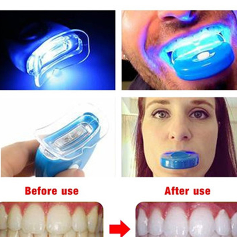 Neue Blaue Led Zähne Bleaching – Teeth Whitening In Office Bewertung und Preis