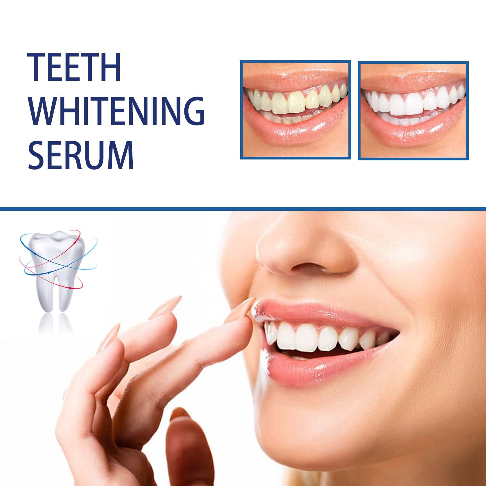 Professionelles Zahnaufhellung – Teeth Whitening Serum Bewertung und Preis