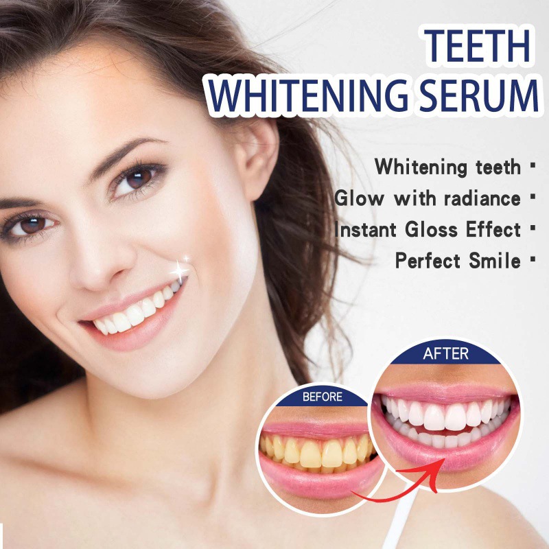 Professionelles Zahnaufhellung – Teeth Whitening Serum Bewertung und Preis