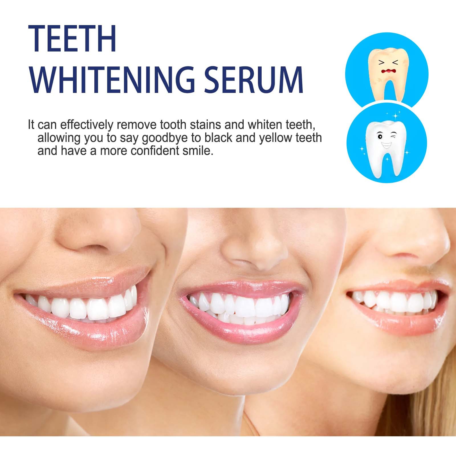 Professionelles Zahnaufhellung – Teeth Whitening Serum Bewertung und Preis