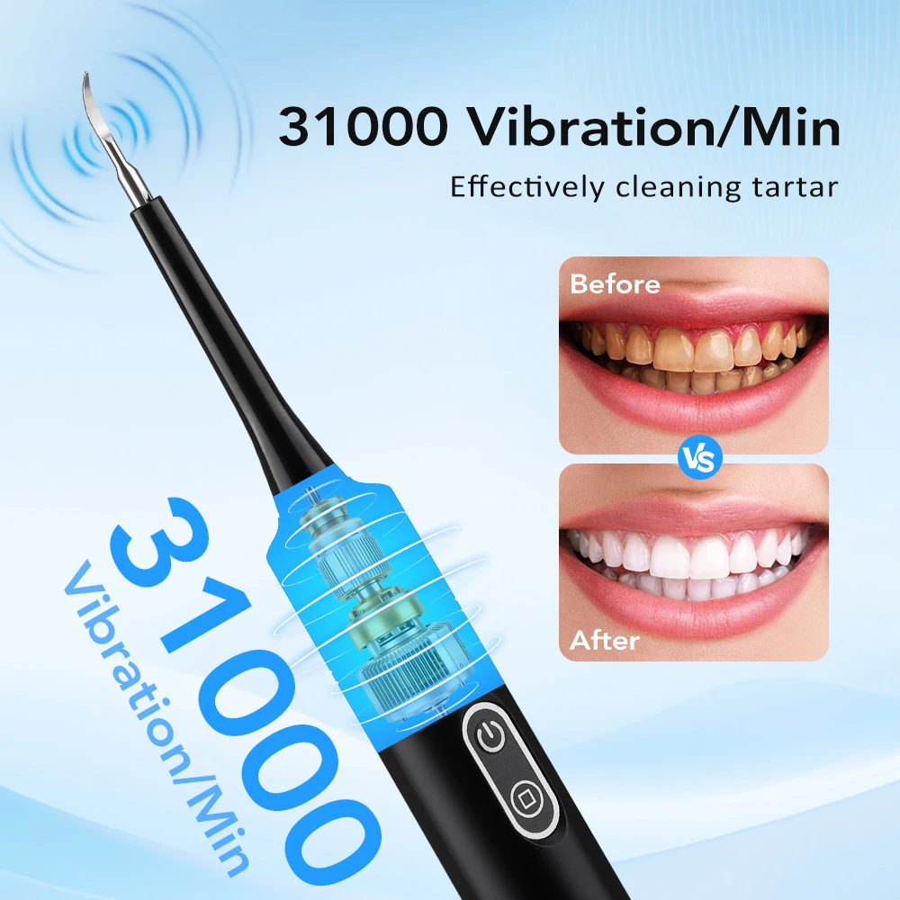 Elektrischer Schallvibrations- – Whitening Teeth Dentist Bewertung und Preis